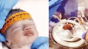 Ahsen bebeği düşürüp öldürdüler… Özel hastanedeki skandala 6'şar yıl