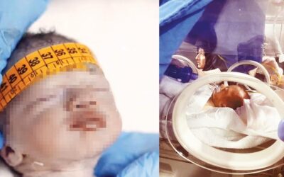 Ahsen bebeği düşürüp öldürdüler… Özel hastanedeki skandala 6'şar yıl