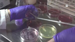 Bozuk gıdaları renklerle belirleyecek! Çalışma tescil aldı