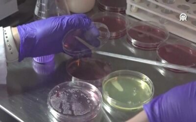 Bozuk gıdaları renklerle belirleyecek! Çalışma tescil aldı