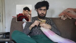Doktorlar Barış'a teşhis koydu: Tedavisi başladı
