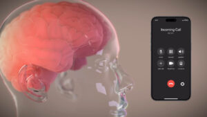 Düşünceleriniz yazıya dönüşebilir mi? Neuralink’in yeni klinik çalışması