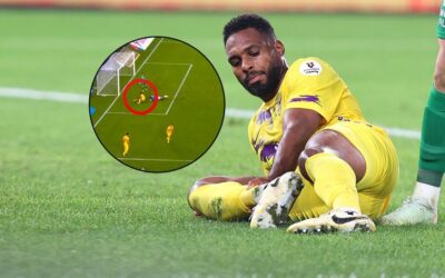 Korkutan sakatlık! Ayağı kırıldı