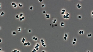 Ölü taklidi yapan süper bakteriler, uzayı bile tehdit ediyor