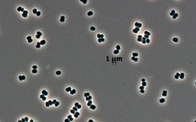 Ölü taklidi yapan süper bakteriler, uzayı bile tehdit ediyor