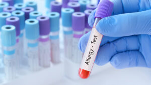 Bir insanın, diğer insanlara karşı gerçekten alerjisi olabilir mi?