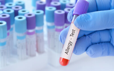 Bir insanın, diğer insanlara karşı gerçekten alerjisi olabilir mi?