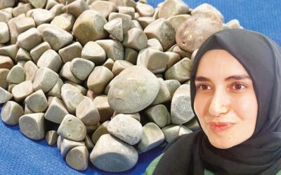 Vücudundan 287 taş çıkartıldı! "Çok nadir bir olay"